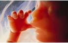 В Беларуси абортируется каждая шестая беременность